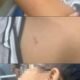 Penuh Memar dan Bekas Gigitan, Bocah Palembang Jadi Korban Kekerasan ART yang Dipercaya Keluarga